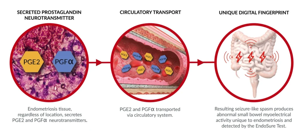 pg secretion slide march 6