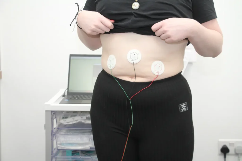 sensors placed on the stomach